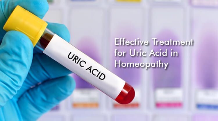  Effective Treatment for Uric Acid in Homeopathy