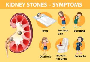 kidney stones symptoms