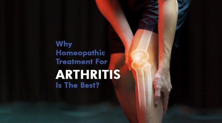  Why Homeopathic Treatment For Arthritis Is The Best?