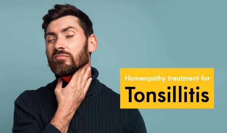  Homeopathy is the best alternative treatment for tonsillitis