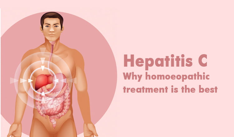  Hepatitis C – Why homoeopathic treatment is the best
