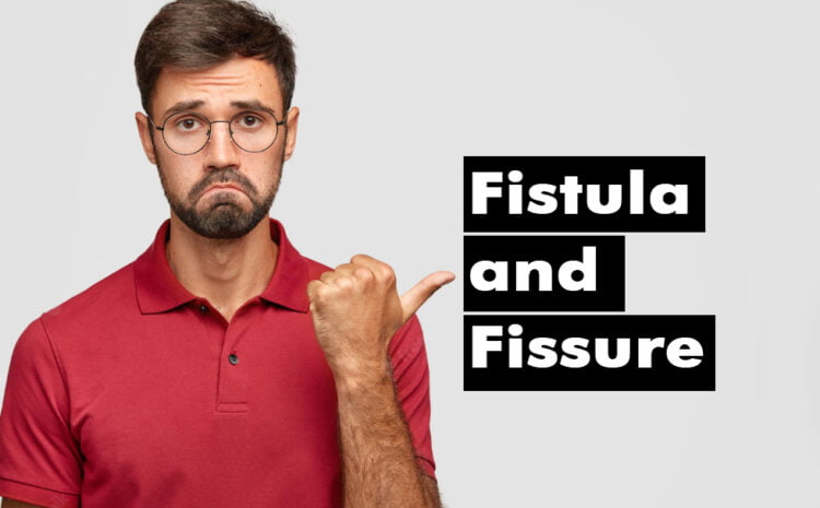 What are Fistula and Fissure? Can they be treated using Homeopathy?