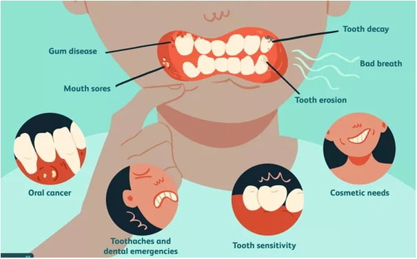  9 Homeopathic Medicines for Mouth Problems
