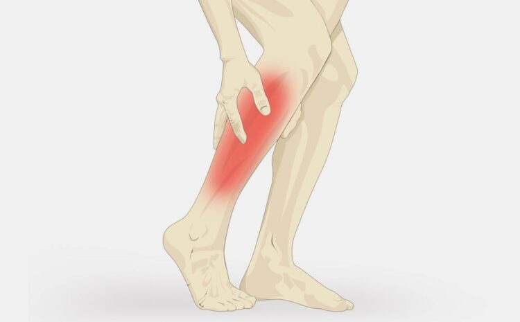  Homeopathy Medicines for Muscle Cramps